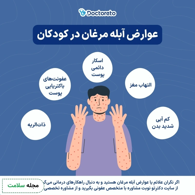 اینفوگرافی عوارض آبله مرغان در کودکان