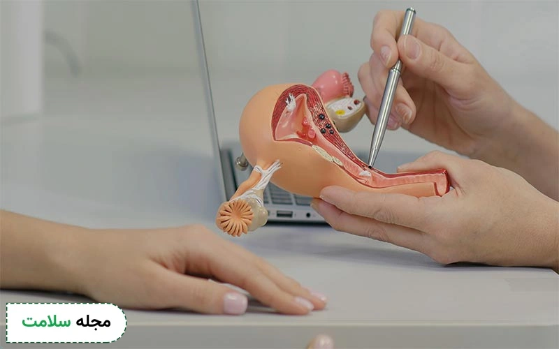 بیماریهای مقاربتی میتوانند باعث ایجاد عفونت در رحم شوند. این عفونت پوشش داخلی رحم را ملتهب میکند.