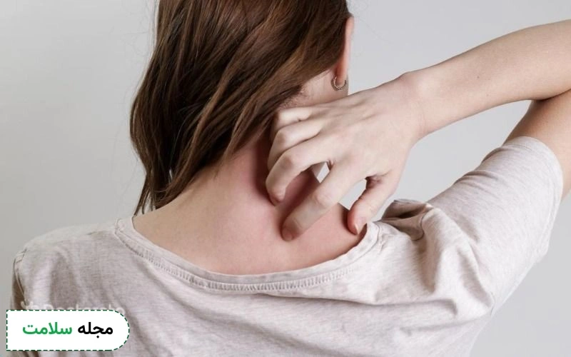 نحوه شستشوی زخم زونا چگونه است؟ برای شستن تاول ها از چه محلولی استفاده کنیم؟