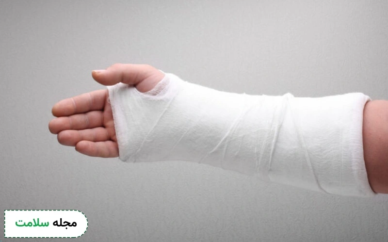 علائم رایج شکستگی دست درد و کبودی است.