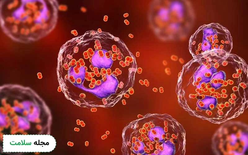 بیماری سوزاک در بیشتر موارد بدون علامت است و مشکلات جدی ایجاد میکند.