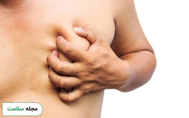 تورم و سنگینی در ژنیکوماستی