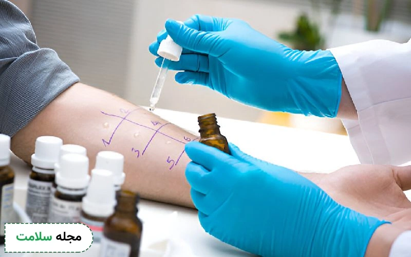 آزمایش حساسیت پوستی