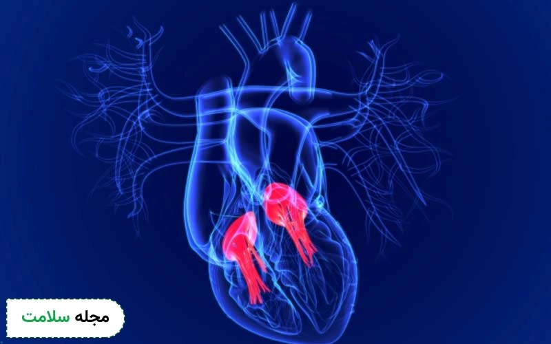 عمل گشادی دریچه قلب چگونه انجام می شود؟ نکات مراقبتی و عوارض این جراحی