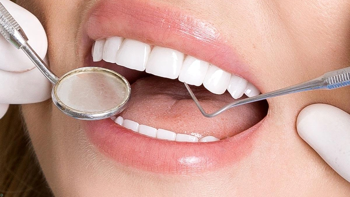 تفاوت لمینت و کامپوزیت دندان؛ کدام روش برای لبخند شما حرفهایتر است؟