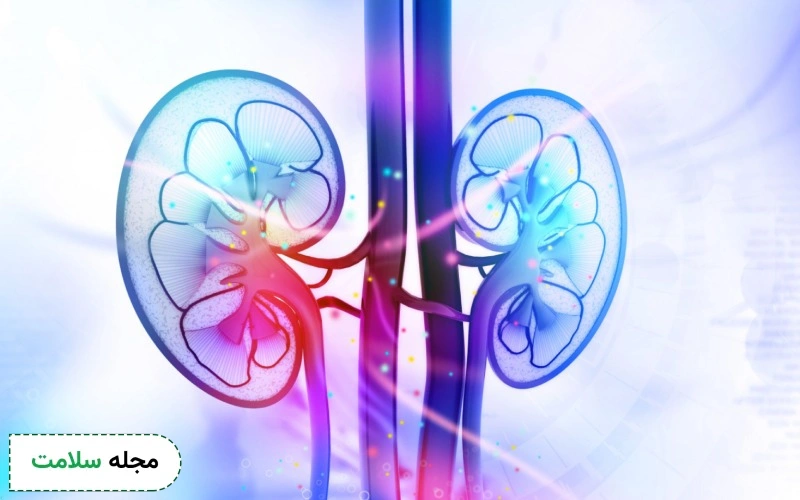 آیا سندروم آلپورت باعث نارسایی کلیه میشود؟
