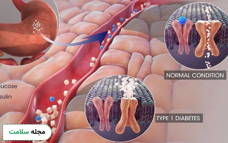 آیا دیابت ارثی است؟