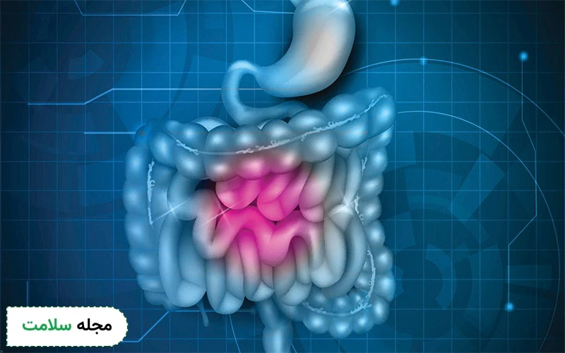 تومور استرومال دستگاه گوارش (GIST) چیست؟ چه علائمی دارد و چگونه درمان می شود؟