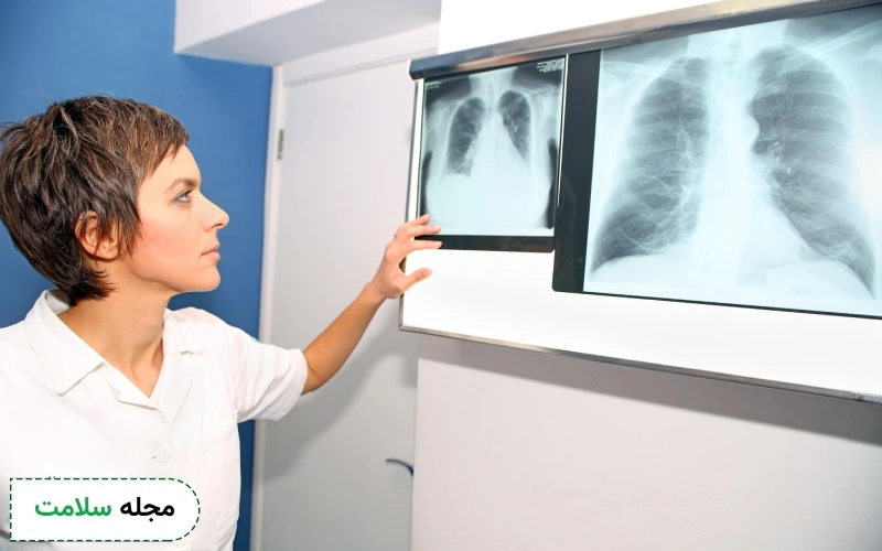 آزمایش فشار خون ریه