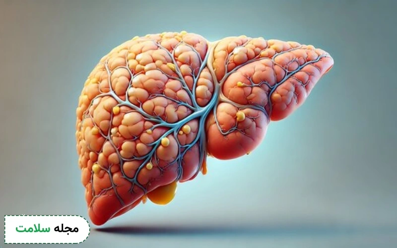 دلیل بروز فیبروز کبد چیست؟