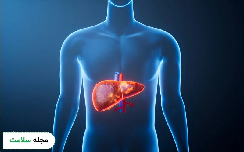 همه چیز در مورد سیروز صفراوی اولیه و ثانویه