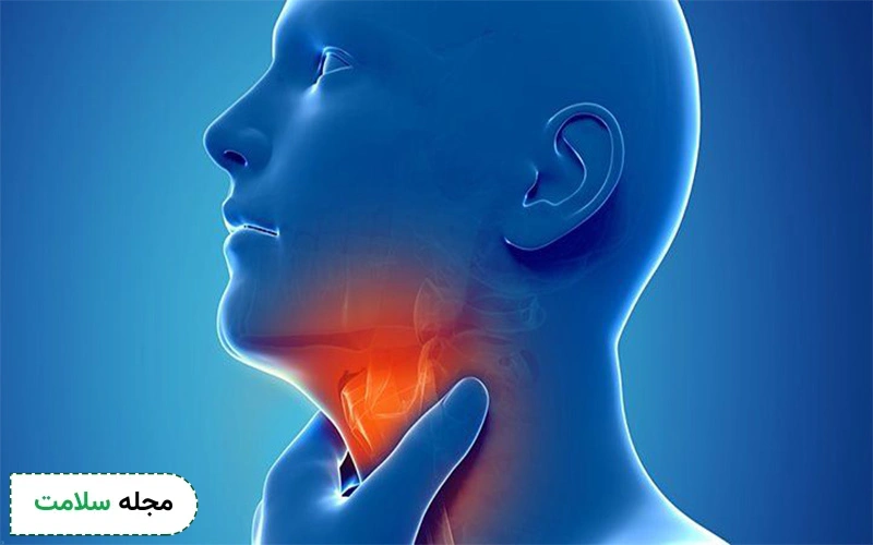 بالارفتن حساسیت تارهای صوتی بعد از سرماخوردگی احتمال ابتلا به رفلاکس حنجره را بیشتر میکند.