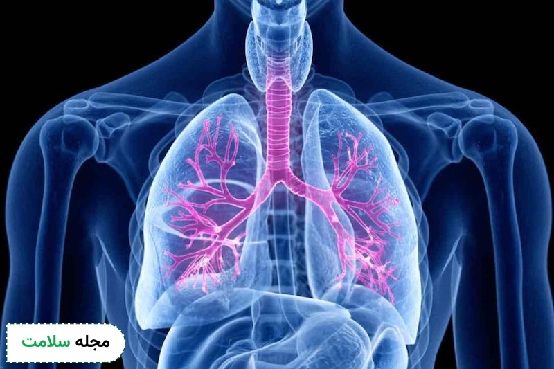برونشیت ریه چیست و چه علائمی دارد؟