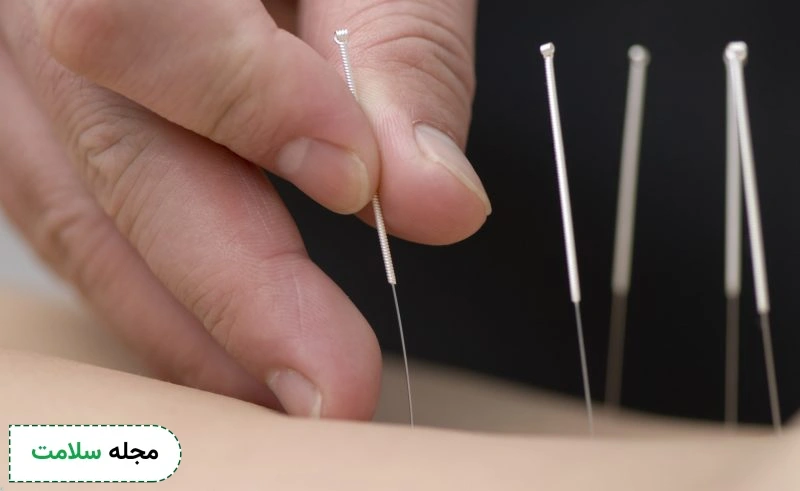 طب سوزنی برای درمان سرطان پروستات