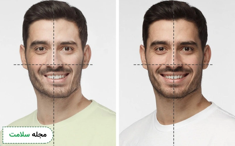 روش انجام جراحی فک چگونه است؟