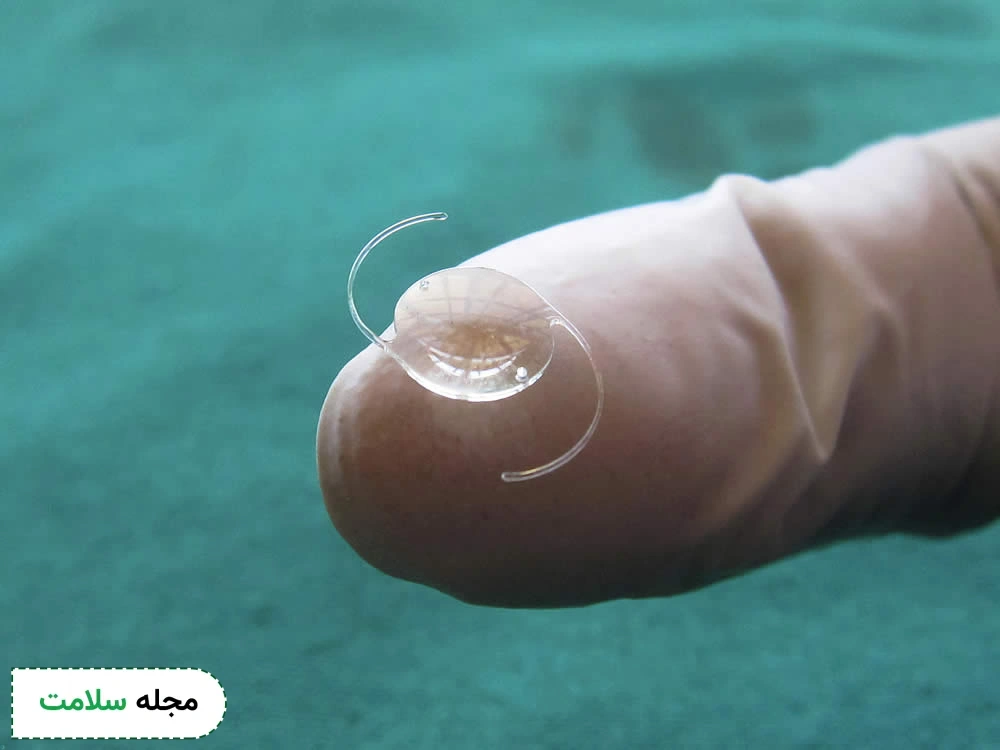 iol implants vs contact lens