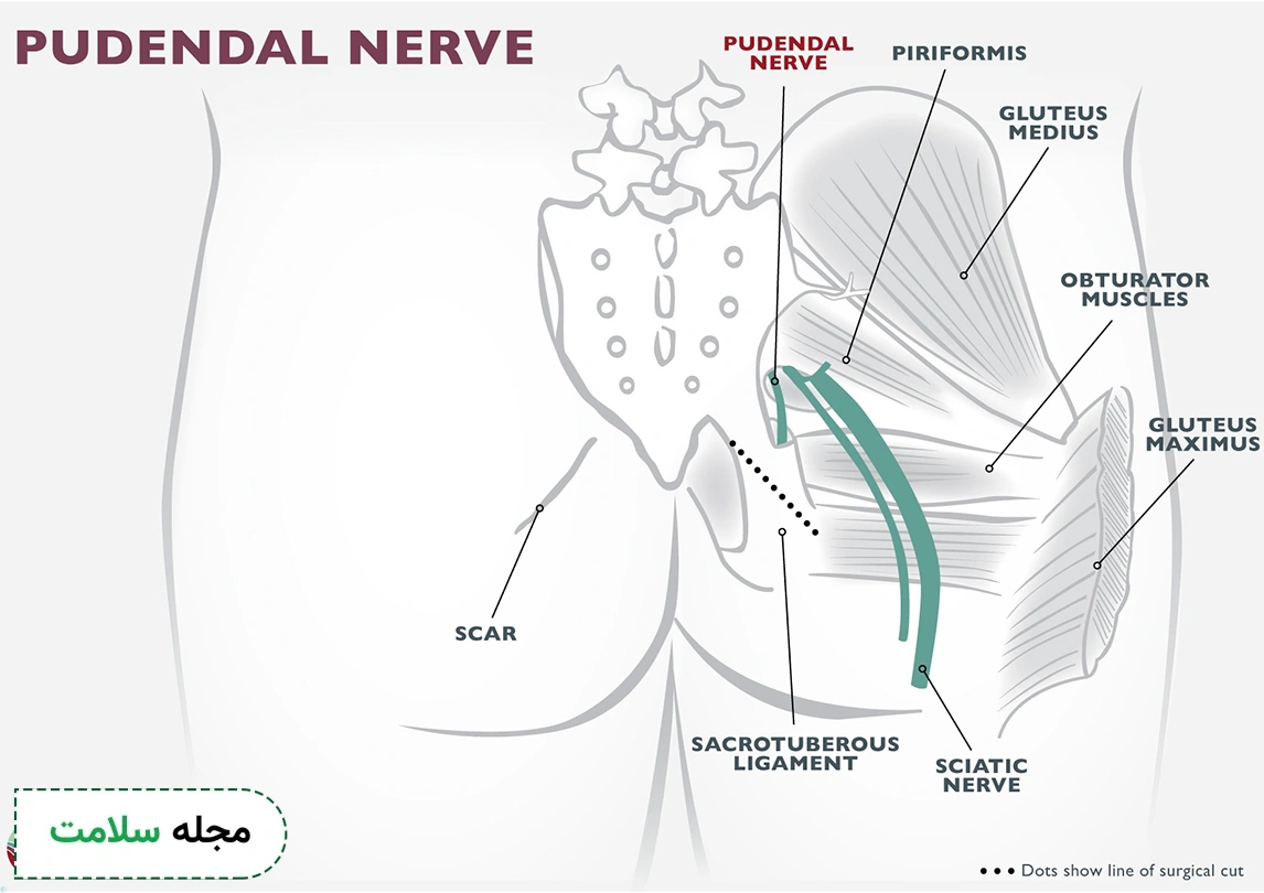 pudendal nerve and vaginal pain