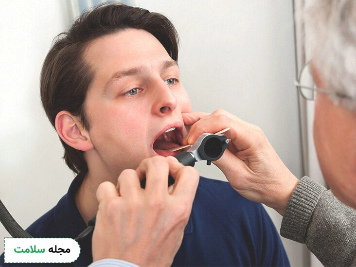 esophageal ulcer