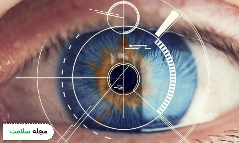 عمل PRK چیست و چگونه انجام می‌شود؟ تفاوت PRK با لیزیک و لازک چیست؟