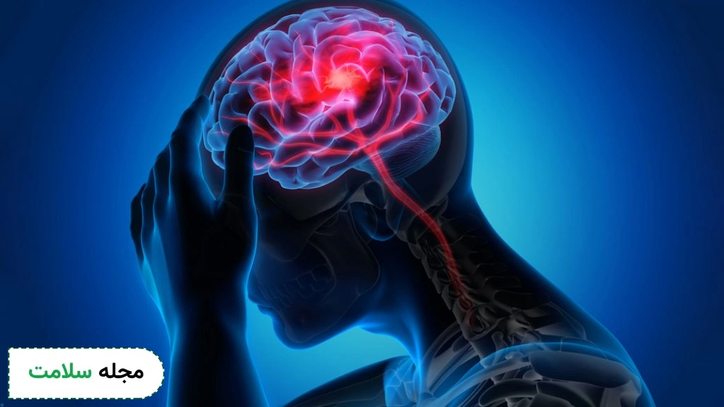 لخته شدن خون در مغز یا سکته مغزی