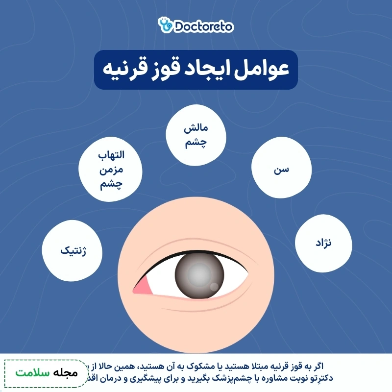 علت قوز قرنیه چیست؟ 