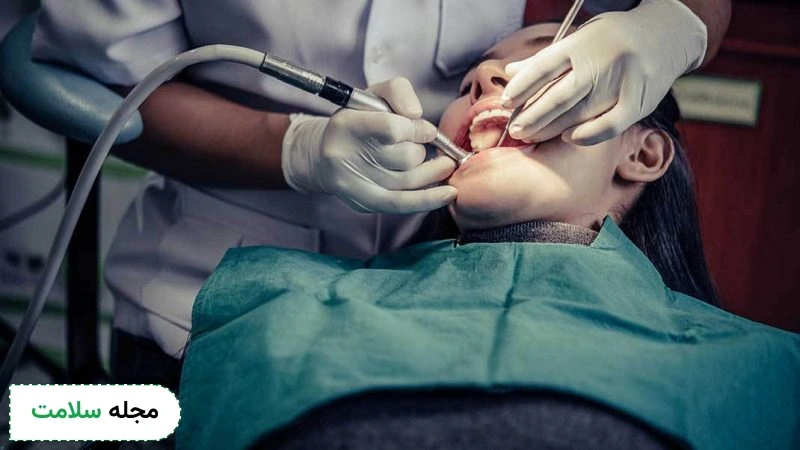 پر کردن دندان چیست و بهترین ماده پرکننده دندان کدام است؟
