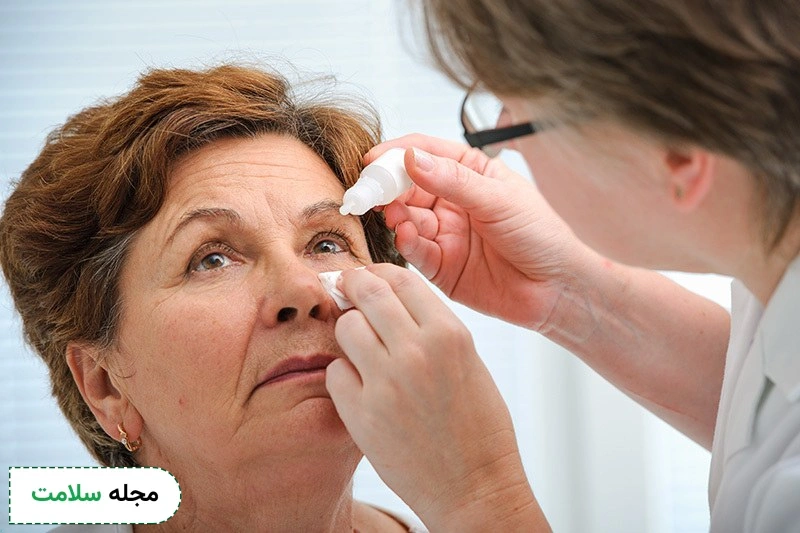 Intraocular Lens Implants after care