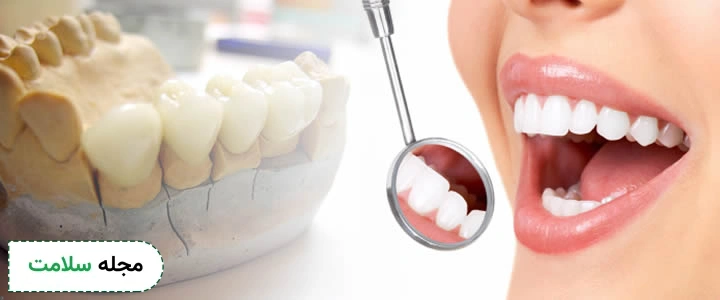 dental prostheses BENEFITS