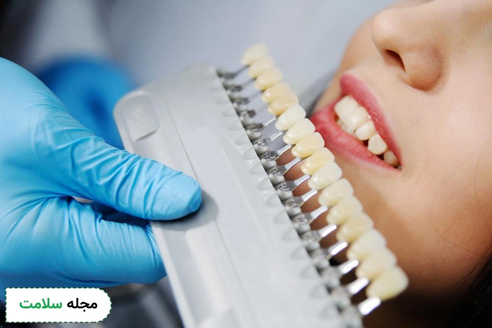 dental crown 