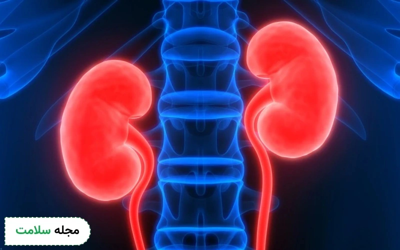 پیشگیری از ابتلا به سرطان کلیه ممکن است؟