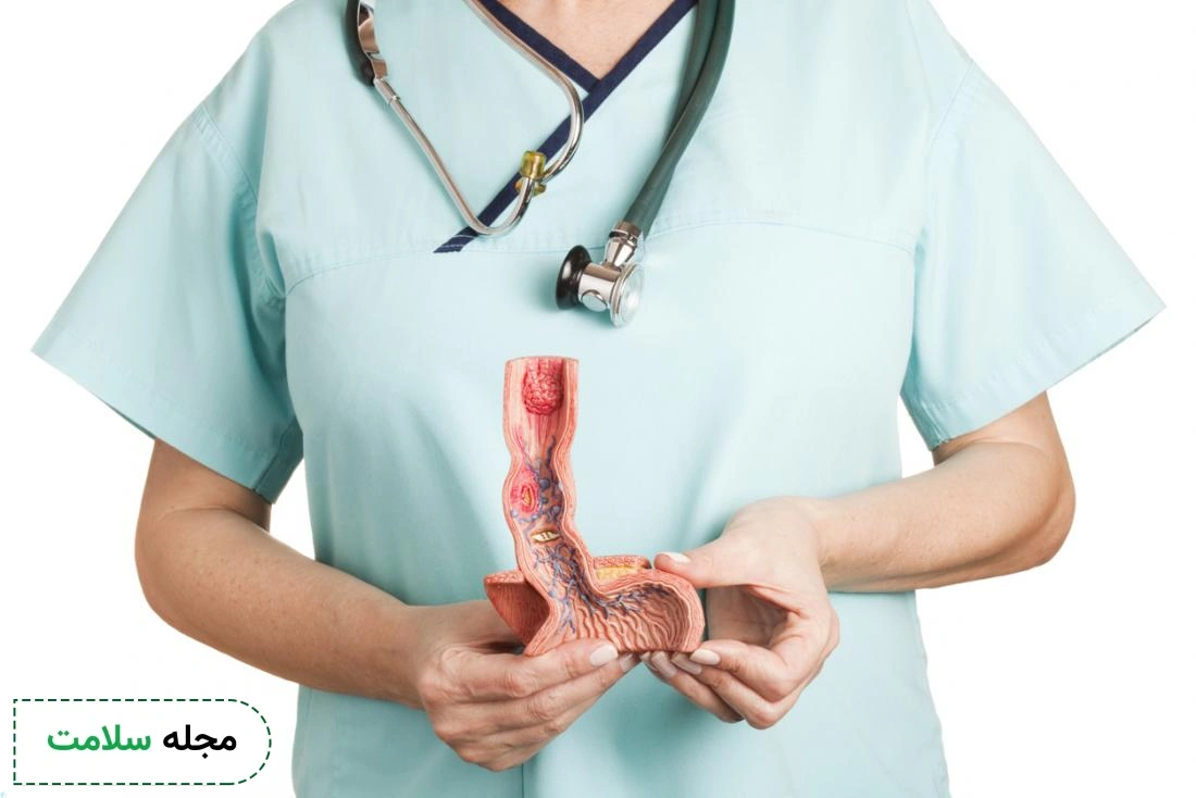 esophageal ulcer