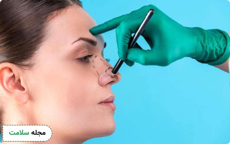 مراقبت های بعد از عمل تیغه بینی چه هستند؟