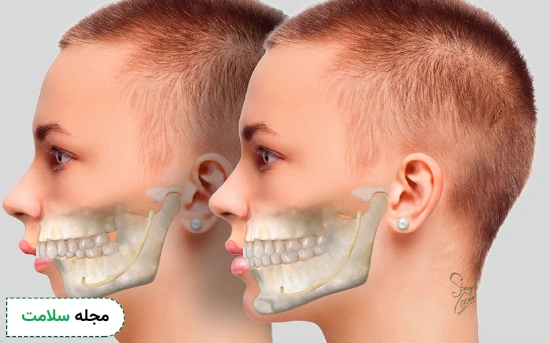 جراحی فک برای چه کسانی مناسب است؟