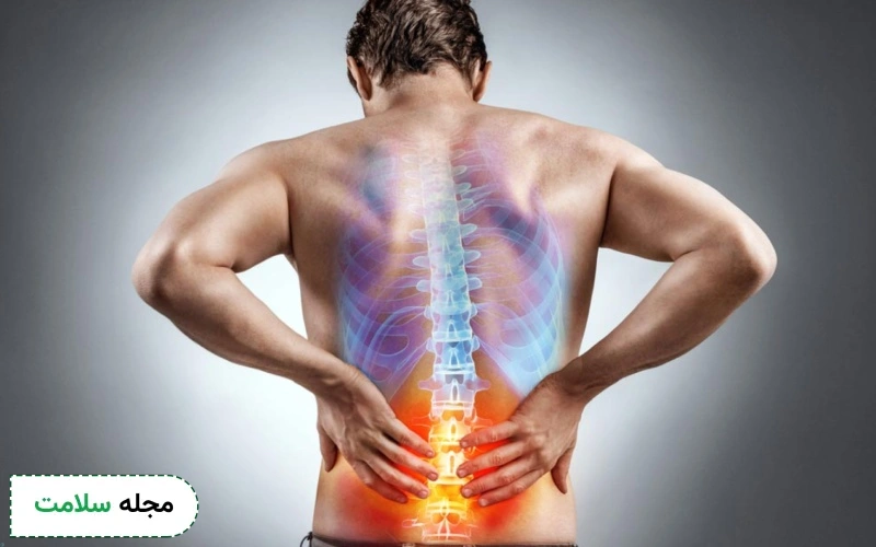 شایع ترین بیماری ها و مشکلات ستون فقرات، علائم، تشخیص و درمان