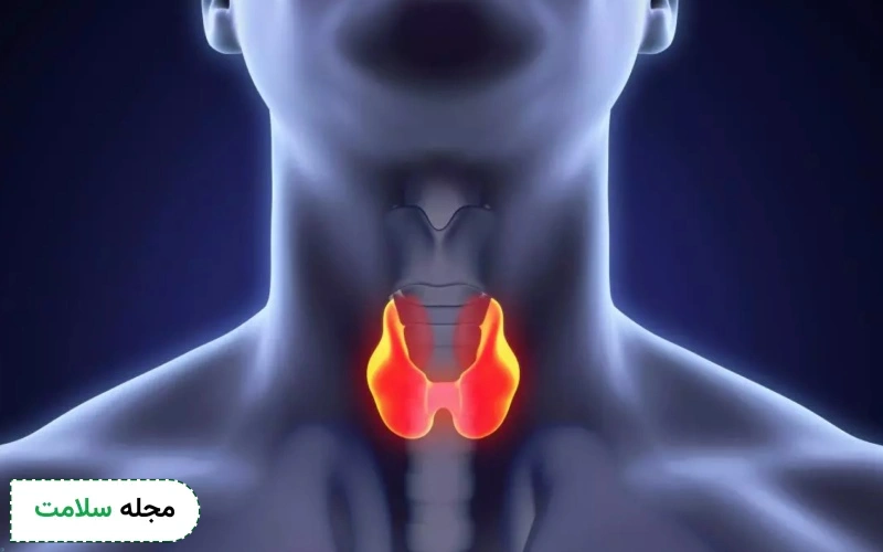 بیماری های مربوط به تیروئید در چه افرادی ایجاد می شود؟