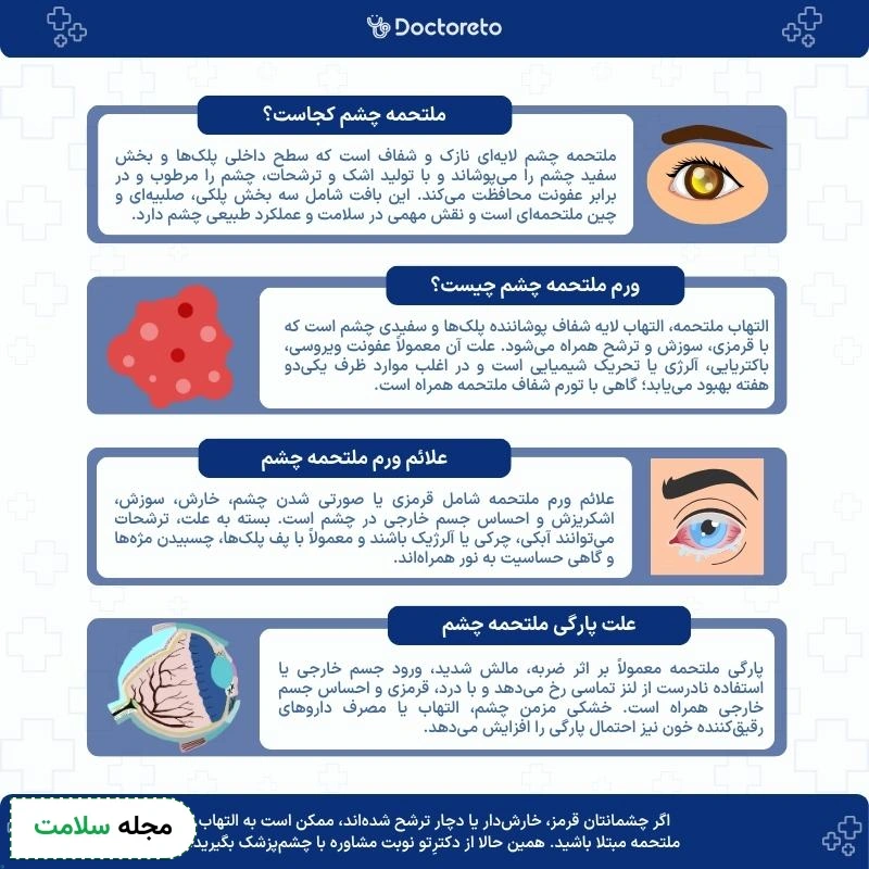 اینفوگرافی ملتحمه چشم