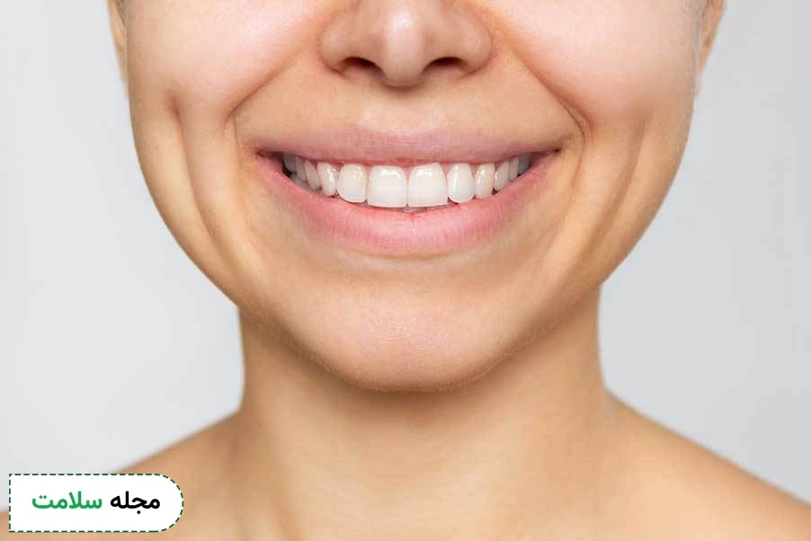 dental restoration