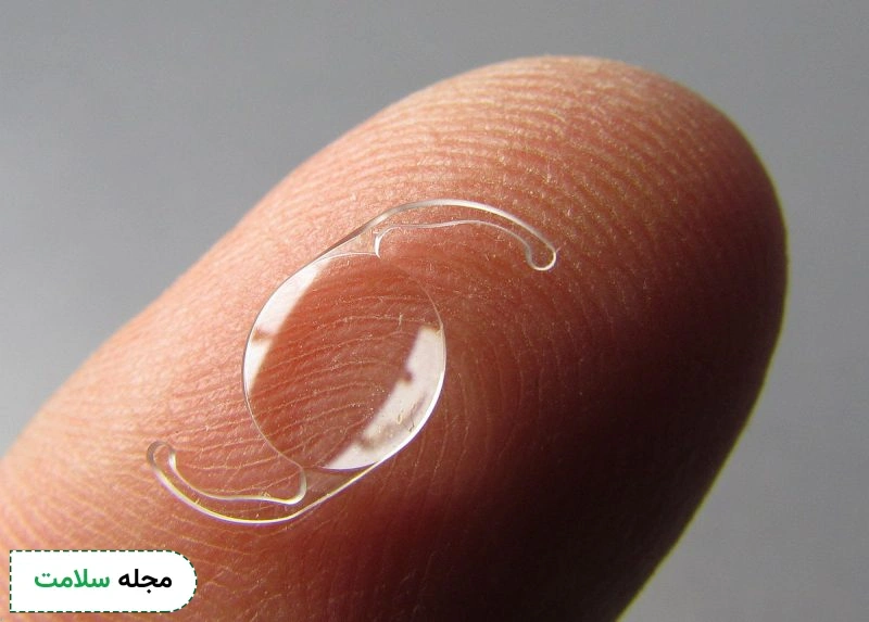 عمل کاشت لنز چیست؟ آشنایی با انواع لنز دائمی و نحوه‌ی عمل لنز داخل چشمی!