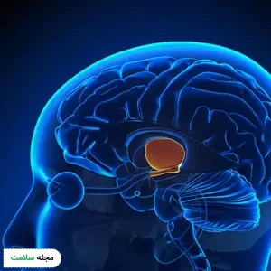 سردرد ناشی از غده هیپوفیز