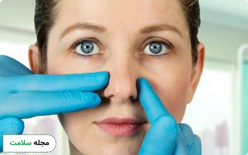 انحراف بینی چیست؟ آشنایی با 6 مورد از علائم سپتوم و روش درمان انحراف تیغه بینی