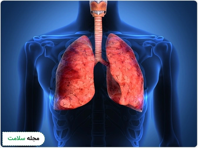 آسم بیماری ریه هاست
