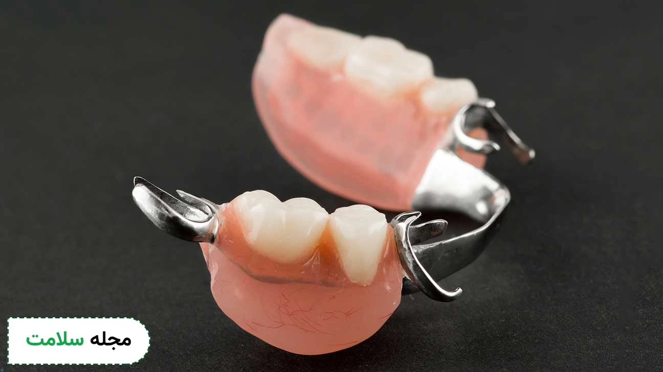 PORTAL dental prostheses