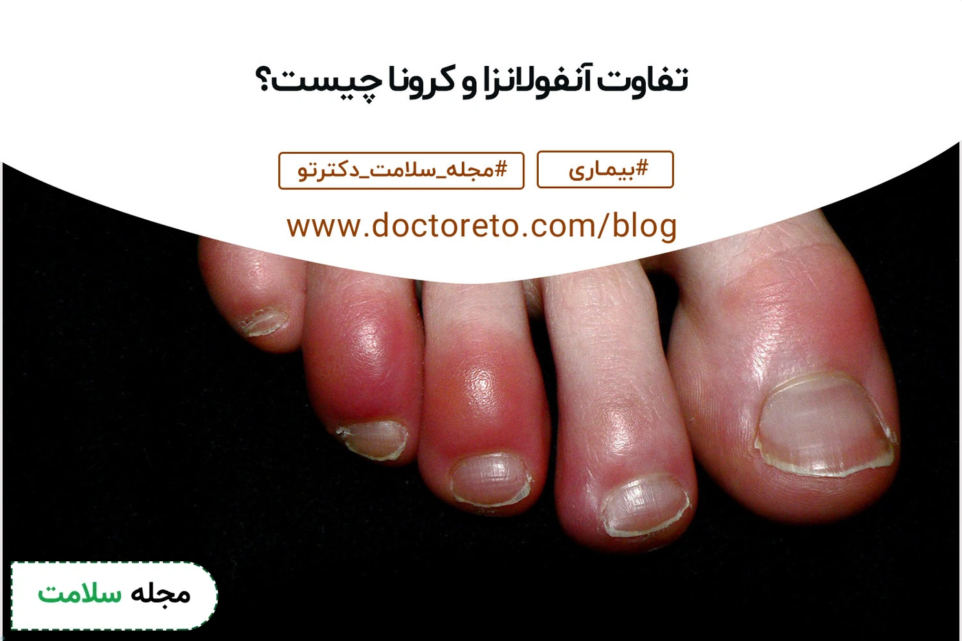تفاوت علائم، علل و روش درمان کرونا و آنفولانزا