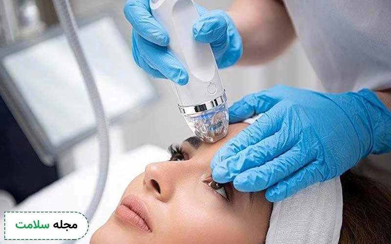 تفاوت روش انجام آر اف با میکرونیدلینگ در چیست؟