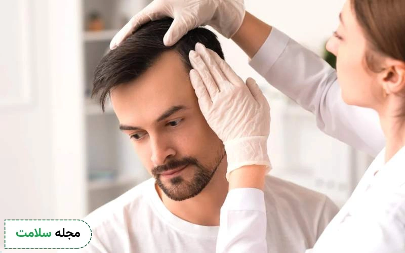 بعد از کاشت مو چی بخوریم؟
