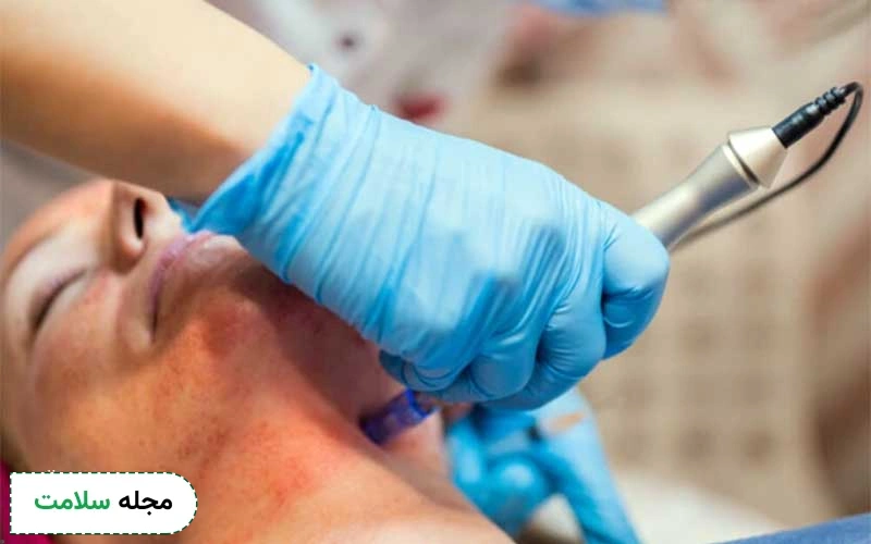 احتمال بروز لک بعد از میکرونیدلینگ چقدر است؟