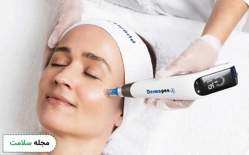 آر اف بهتر است یا میکرونیدلینگ؟