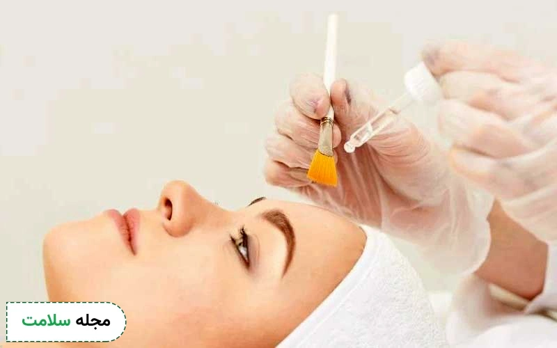 یکی از نکات مراقبت بعد از اسید تراپی پرهیز از لایه برداری است.
