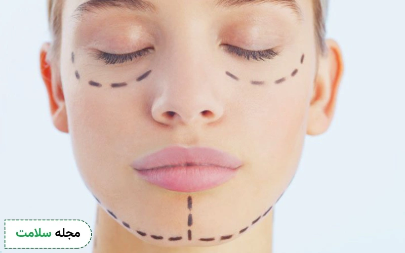 کانتورینگ صورت چگونه انجام میشود؟ عوارض مادلینگ صورت چیست؟