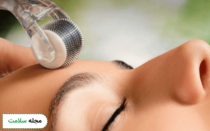 تفاوت میکرونیدلینگ و مزونیدلینگ در چیست؟
